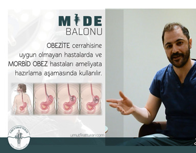 MİDE BALONU ve ÇEŞİTLERİ NELERDİR?